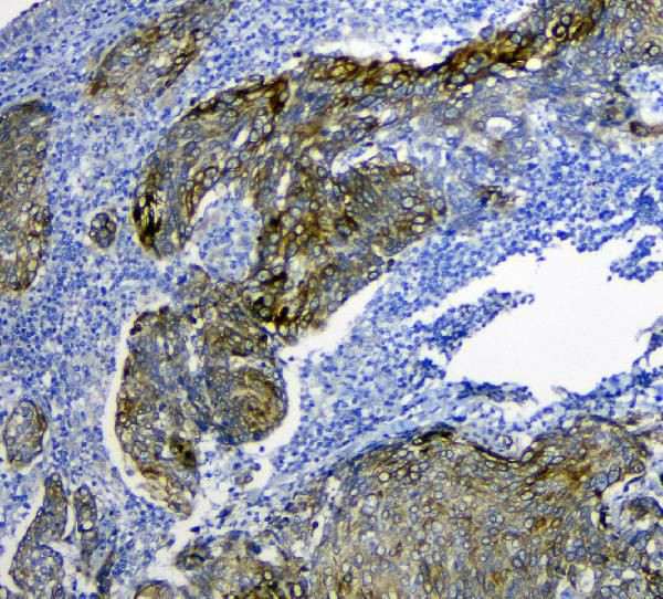 SLC34A2 Antibody in Immunohistochemistry (Paraffin) (IHC (P))