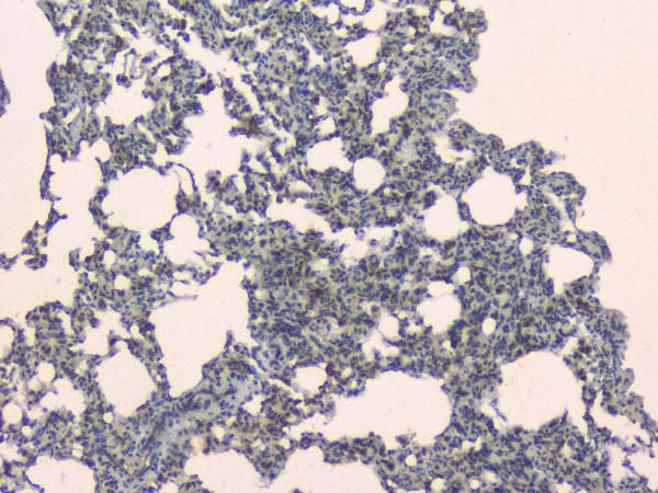 SLC34A2 Antibody in Immunohistochemistry (Paraffin) (IHC (P))