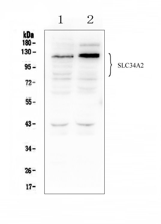 SLC34A2 Antibody in Western Blot (WB)