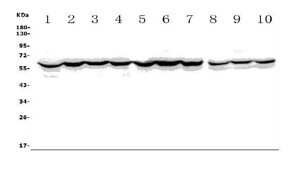 ASIC2 Antibody in Western Blot (WB)