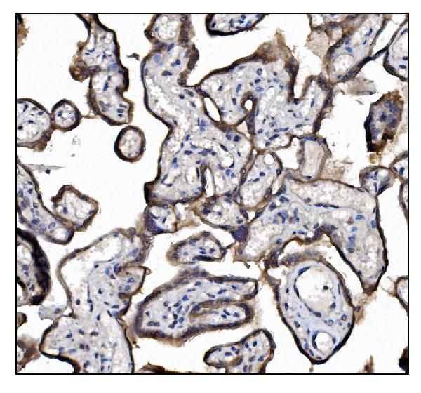 UGT1A3 Antibody in Immunohistochemistry (Paraffin) (IHC (P))