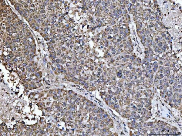 NDUFS5 Antibody in Immunohistochemistry (Paraffin) (IHC (P))