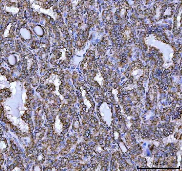 NDUFS5 Antibody in Immunohistochemistry (Paraffin) (IHC (P))