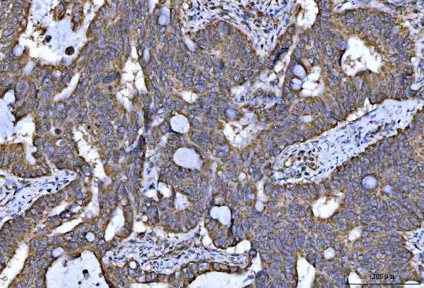 NDUFS5 Antibody in Immunohistochemistry (Paraffin) (IHC (P))