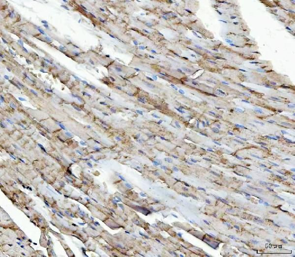 NDUFS5 Antibody in Immunohistochemistry (Paraffin) (IHC (P))