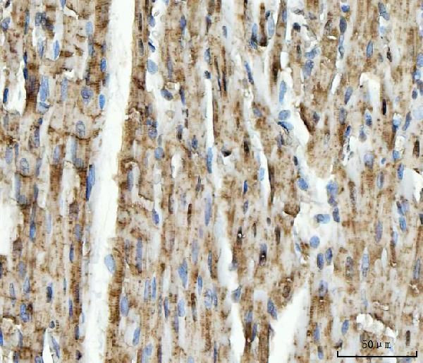 NDUFS5 Antibody in Immunohistochemistry (Paraffin) (IHC (P))