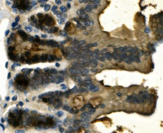 Galectin 2 Antibody in Immunohistochemistry (Paraffin) (IHC (P))