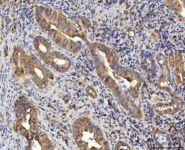 RPL10 Antibody in Immunohistochemistry (Paraffin) (IHC (P))