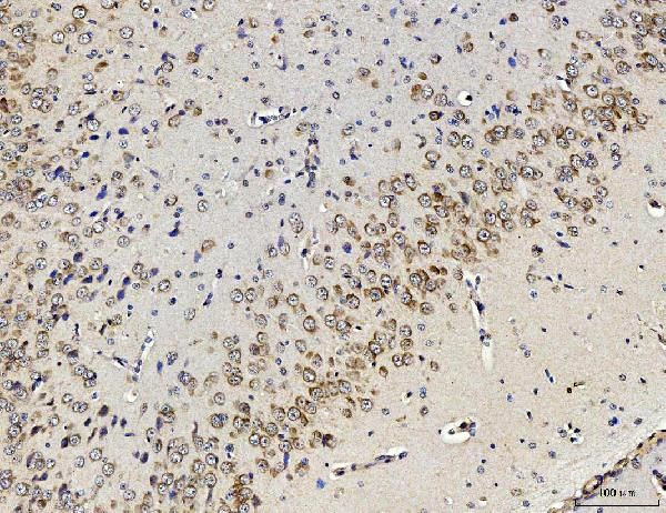 RPL10 Antibody in Immunohistochemistry (Paraffin) (IHC (P))