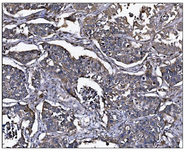 ERAP2 Antibody in Immunohistochemistry (Paraffin) (IHC (P))