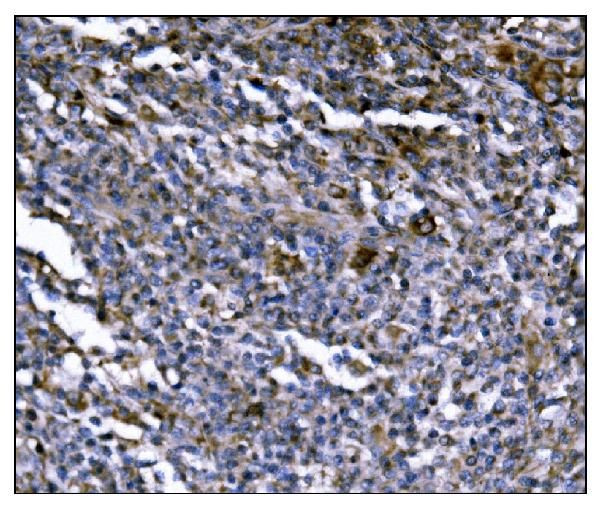 ERAP2 Antibody in Immunohistochemistry (Paraffin) (IHC (P))