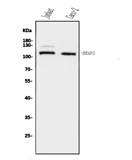 ERAP2 Antibody in Western Blot (WB)