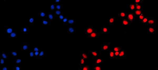 KIF4A/KIF4B Antibody in Immunocytochemistry (ICC/IF)