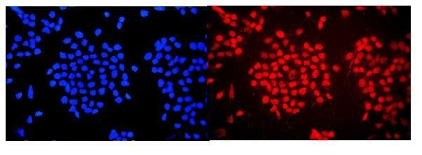 WAC Antibody in Immunocytochemistry (ICC/IF)