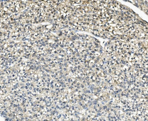 AKR1D1 Antibody in Immunohistochemistry (Paraffin) (IHC (P))