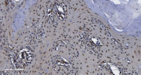 CDK13 Antibody in Immunohistochemistry (Paraffin) (IHC (P))