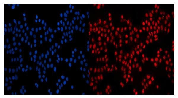 gp210 Antibody in Immunocytochemistry (ICC/IF)