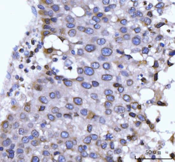 gp210 Antibody in Immunohistochemistry (Paraffin) (IHC (P))