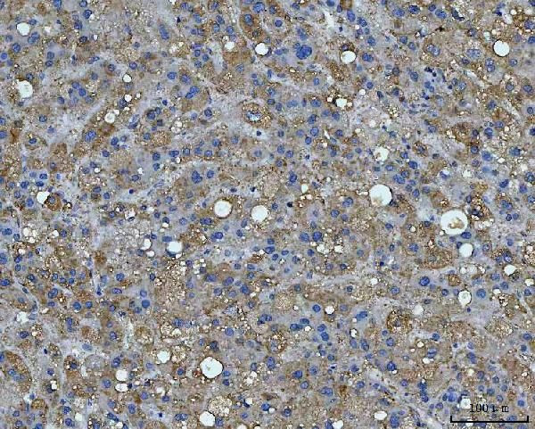 Bi-1 Antibody in Immunohistochemistry (Paraffin) (IHC (P))