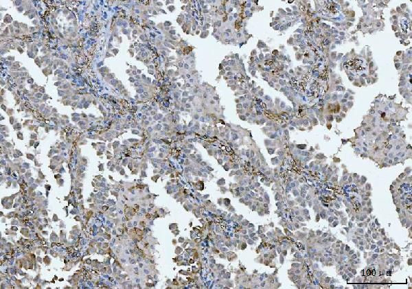 Bi-1 Antibody in Immunohistochemistry (Paraffin) (IHC (P))