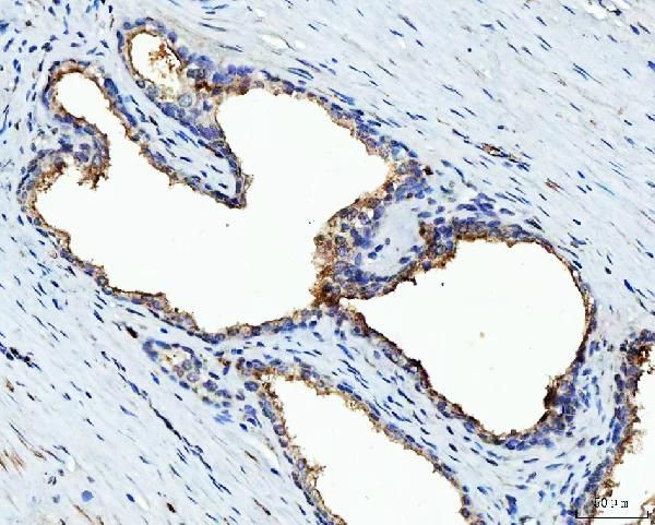 Bi-1 Antibody in Immunohistochemistry (Paraffin) (IHC (P))