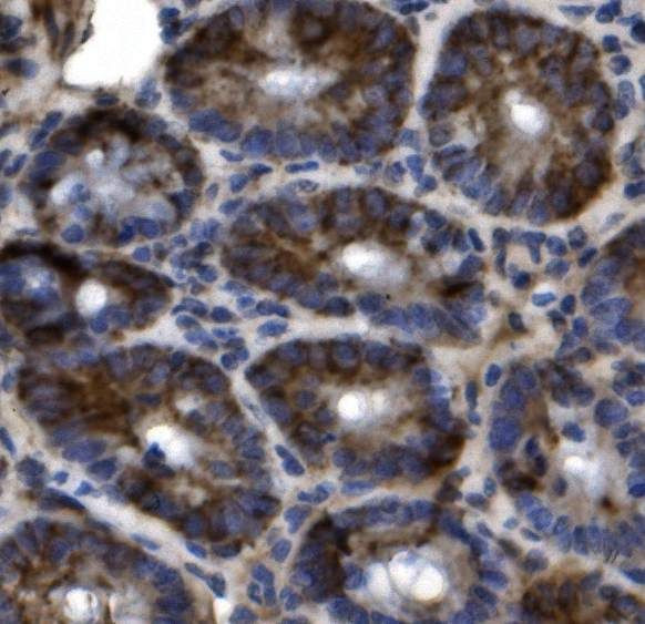 SLC44A2 Antibody in Immunohistochemistry (Paraffin) (IHC (P))