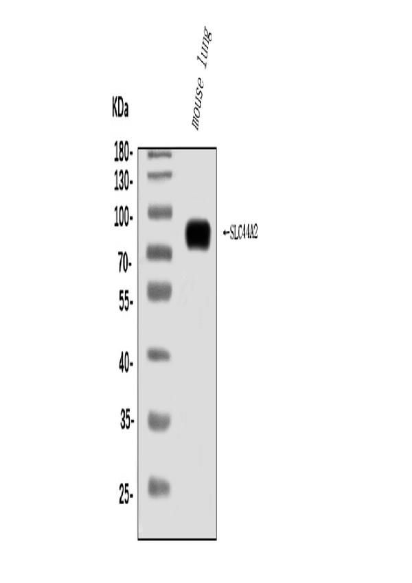 SLC44A2 Antibody in Western Blot (WB)