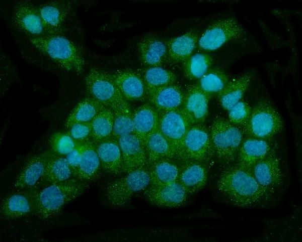 DNAJC6 Antibody in Immunocytochemistry (ICC/IF)