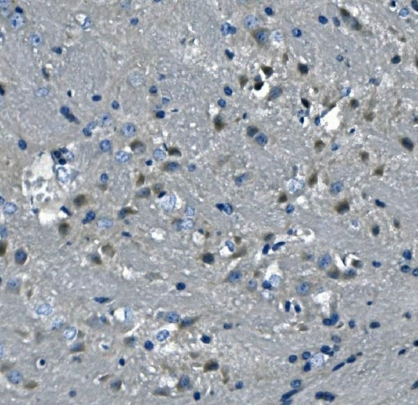 DNAJC6 Antibody in Immunohistochemistry (Paraffin) (IHC (P))