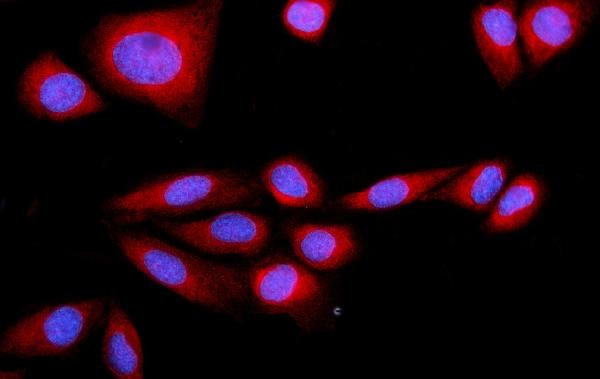 SRP72 Antibody in Immunocytochemistry (ICC/IF)