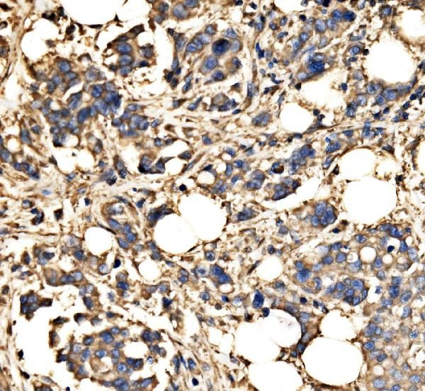 SRP72 Antibody in Immunohistochemistry (Paraffin) (IHC (P))