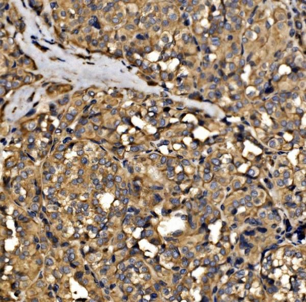 SRP72 Antibody in Immunohistochemistry (Paraffin) (IHC (P))