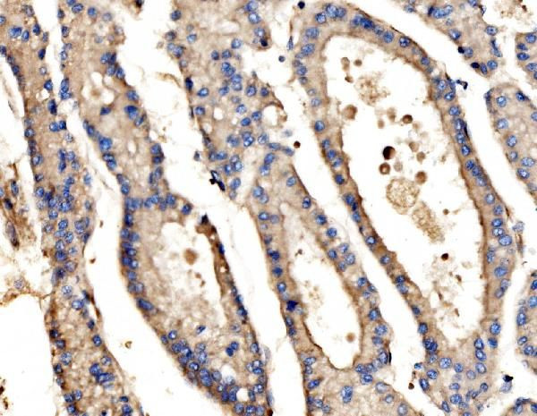 SRP72 Antibody in Immunohistochemistry (Paraffin) (IHC (P))