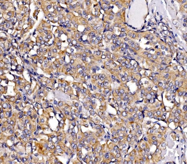 RHOT1 Antibody in Immunohistochemistry (Paraffin) (IHC (P))