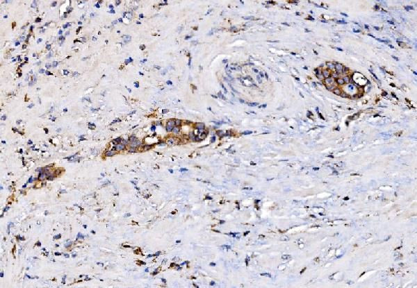 RHOT1 Antibody in Immunohistochemistry (Paraffin) (IHC (P))