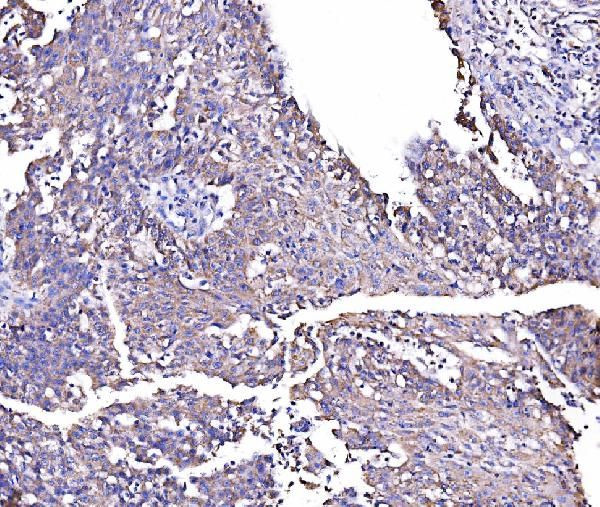 RHOT1 Antibody in Immunohistochemistry (Paraffin) (IHC (P))