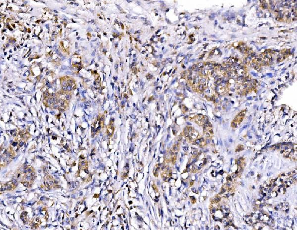 RHOT1 Antibody in Immunohistochemistry (Paraffin) (IHC (P))