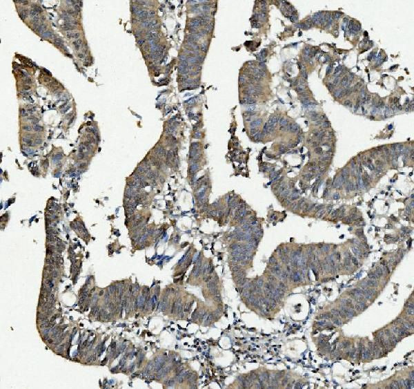 ANAPC2 Antibody in Immunohistochemistry (Paraffin) (IHC (P))