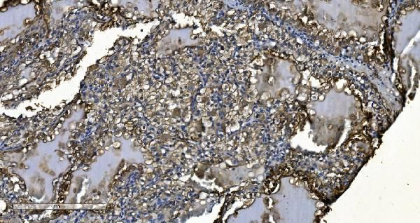 SMCR7L Antibody in Immunohistochemistry (Paraffin) (IHC (P))