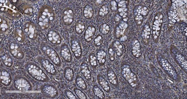 SMCR7L Antibody in Immunohistochemistry (Paraffin) (IHC (P))