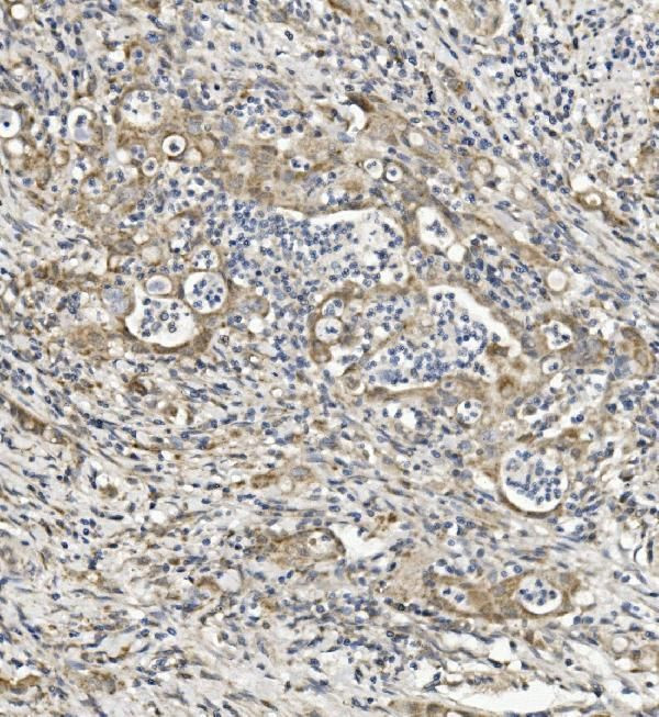 SEMA6A Antibody in Immunohistochemistry (Paraffin) (IHC (P))