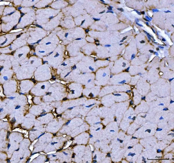 TRIM72 Antibody in Immunohistochemistry (Paraffin) (IHC (P))