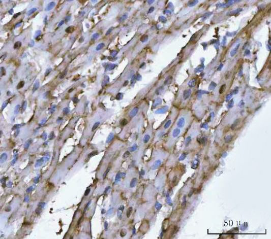 TRIM72 Antibody in Immunohistochemistry (Paraffin) (IHC (P))