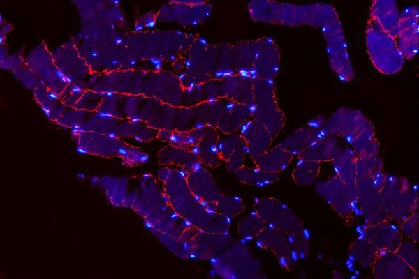 TRIM72 Antibody in Immunohistochemistry (Paraffin) (IHC (P))