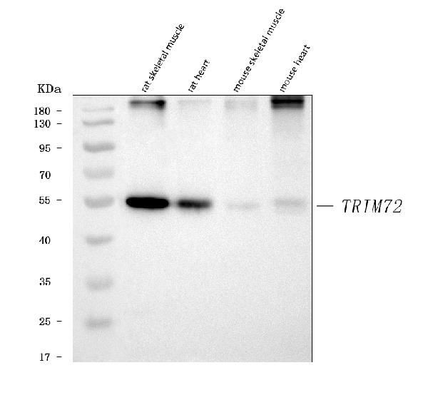 TRIM72 Antibody in Western Blot (WB)