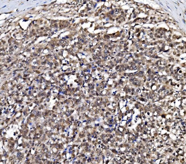 NOLA1 Antibody in Immunohistochemistry (Paraffin) (IHC (P))