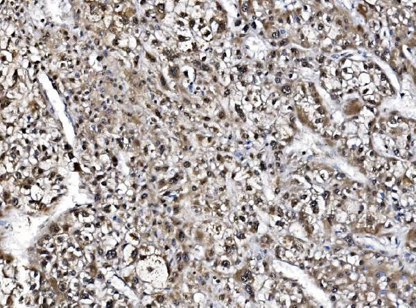 NOLA1 Antibody in Immunohistochemistry (Paraffin) (IHC (P))