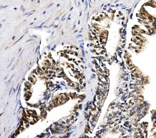 NOLA1 Antibody in Immunohistochemistry (Paraffin) (IHC (P))