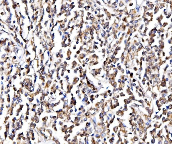 NOLA1 Antibody in Immunohistochemistry (Paraffin) (IHC (P))