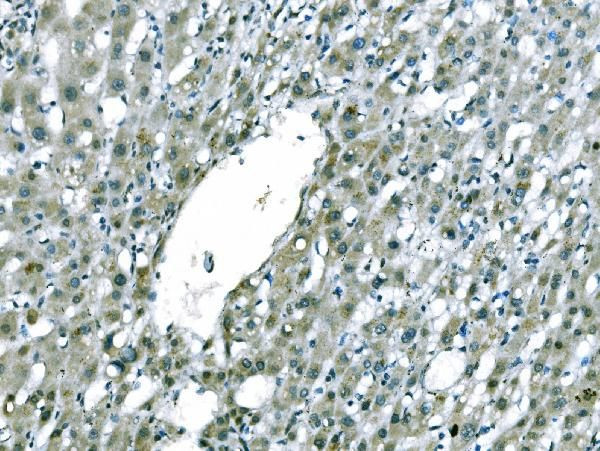 CD101 Antibody in Immunohistochemistry (Paraffin) (IHC (P))